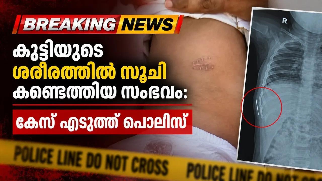 കോട്ടയം മെഡിക്കല് കോളജില് ജനിച്ച കുട്ടിയുടെ ശരീരത്തില് സൂചി കണ്ടെത്തിയ സംഭവത്തില് കേസ് എടുത്ത് പൊലീസ്. മാതാപിതാക്കളു